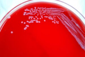 Bacteria and personal hygiene